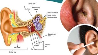 কটনবাড দিয়ে কান পরিষ্কার করলে কী হয়?