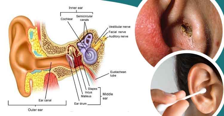 কটনবাড দিয়ে কান পরিষ্কার করলে কী হয়?